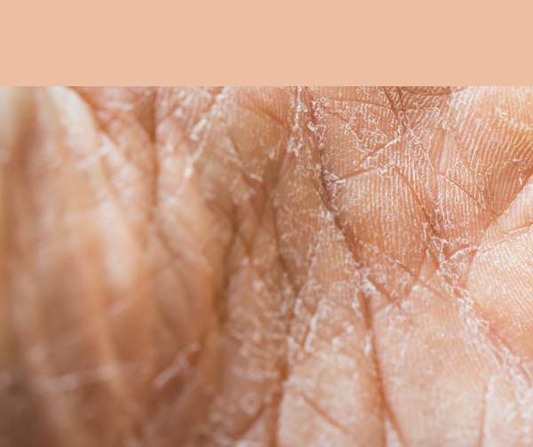 Fußpunkt ®  Islannin sammal, kuivan iho kosteuttaja ja rauhoittava voide